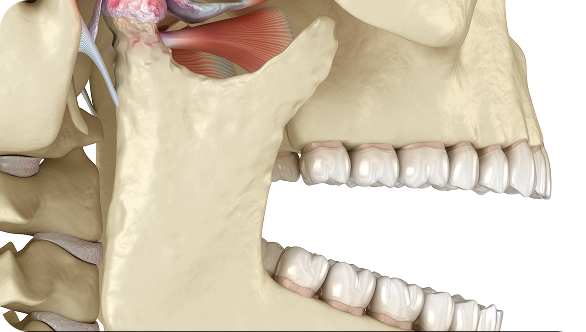 턱관절 치료 After