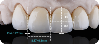 치아 비율 분석