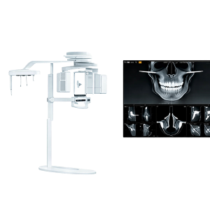 Cephalo 고품질 출력CT